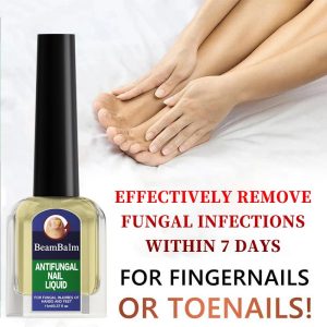【special effects】toenail fungus treatment extra strength,antifungal solution for toenail or fingernail, triple actionformula for remove fungal, repair and renewal damagednails